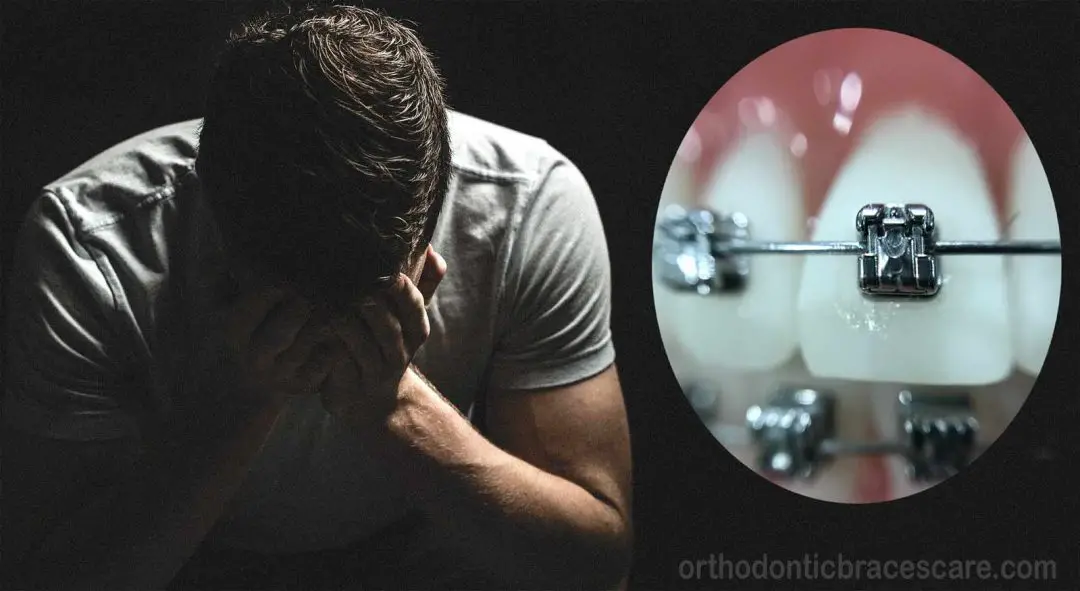 Braces Brackets Fall Off Why This Happens, What To Do Orthodontic