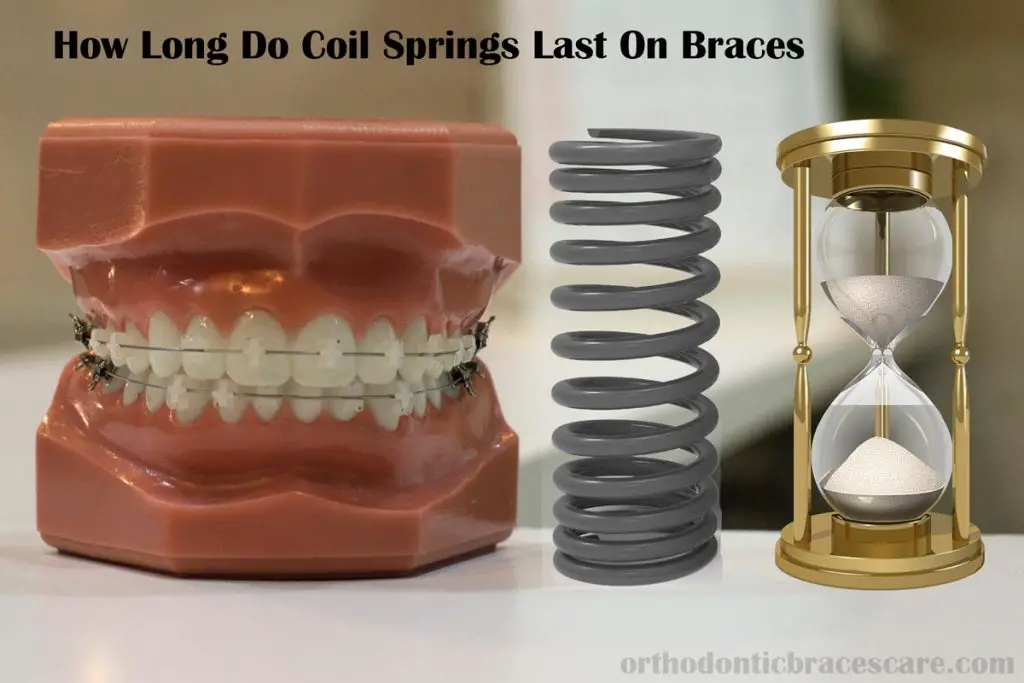 Coil springs do on braces