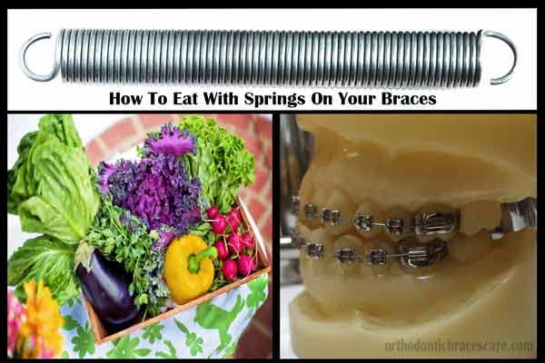 tips to eat with braces springs