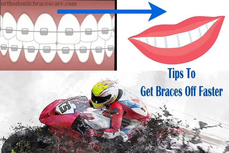 How To Get Braces Off Faster Than Expected? Orthodontic Braces Care