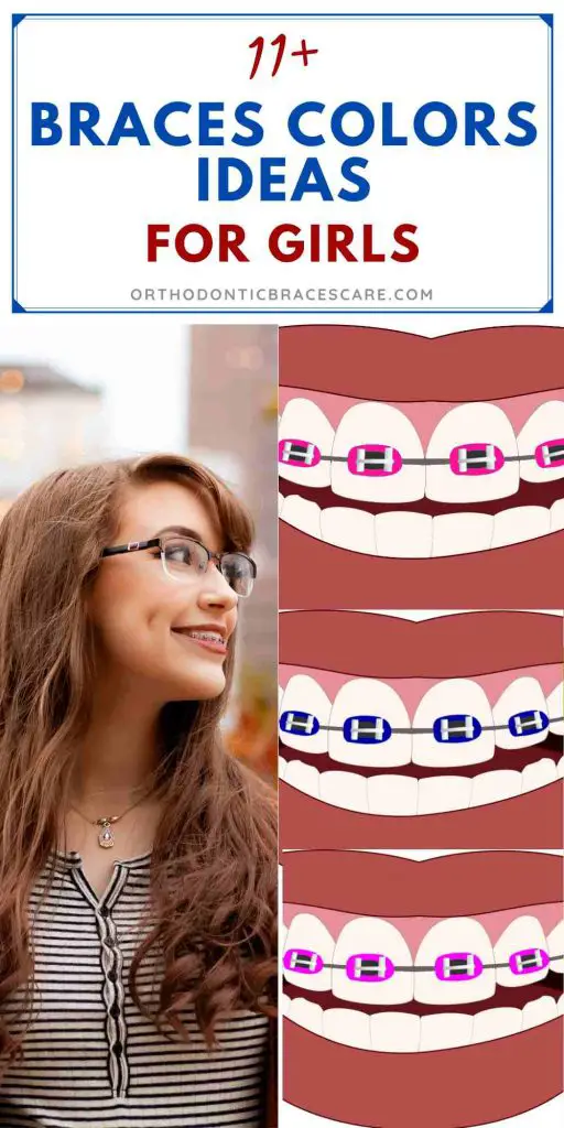 Best braces color ideas for girls