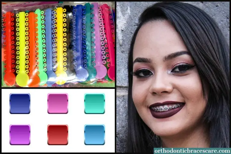 best braces colors for brown skin