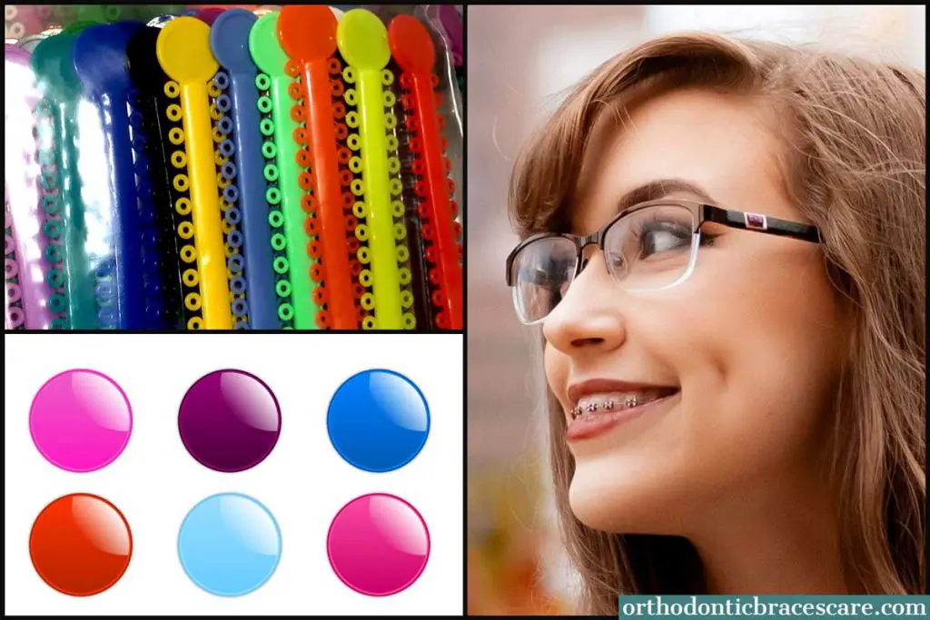 Braces Colors For Girls - choose popular and cute colors