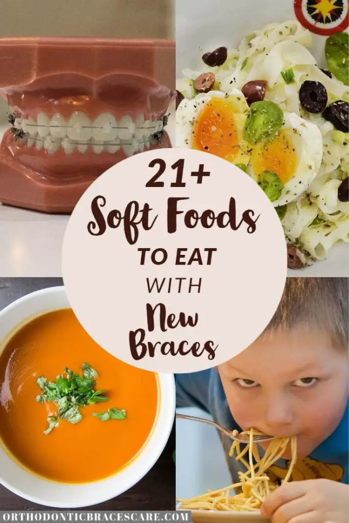 Soft Foods To Eat After Braces Tightening [With List] Orthodontic Braces Care