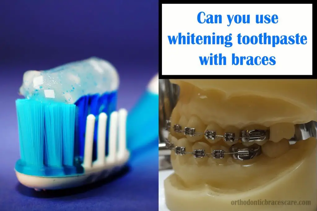 using whitening toothpaste with braces