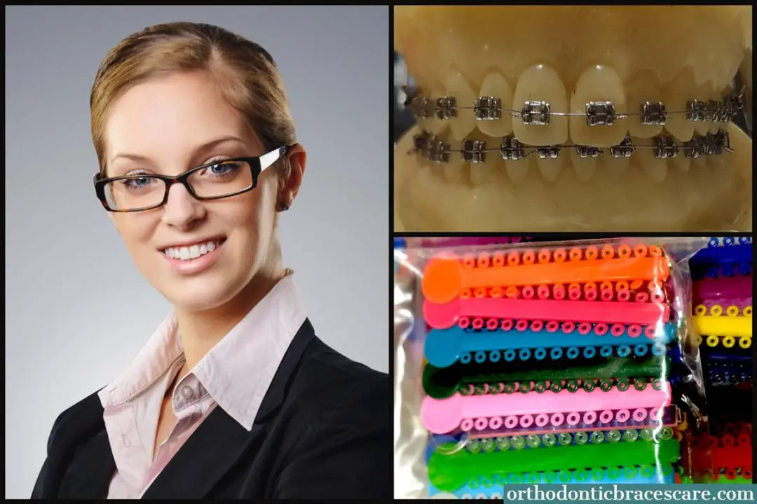 how long do adult typically wear braces