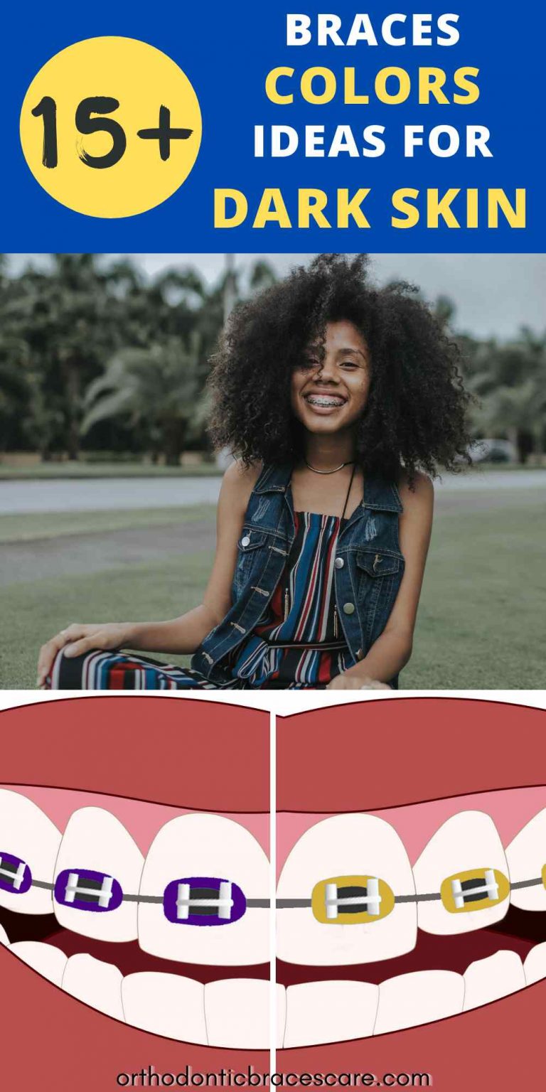 Best Braces Colors For Dark Skin How To Choose Orthodontic Braces Care