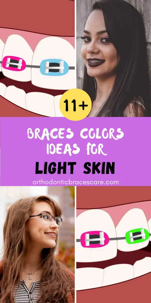 Best Braces Colors Ideas For Light Skin