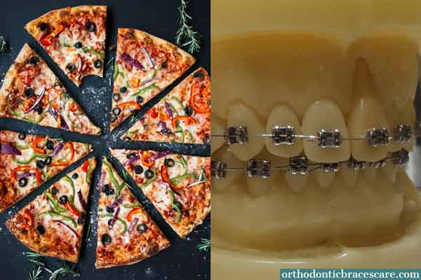 Eating Pizza With Braces