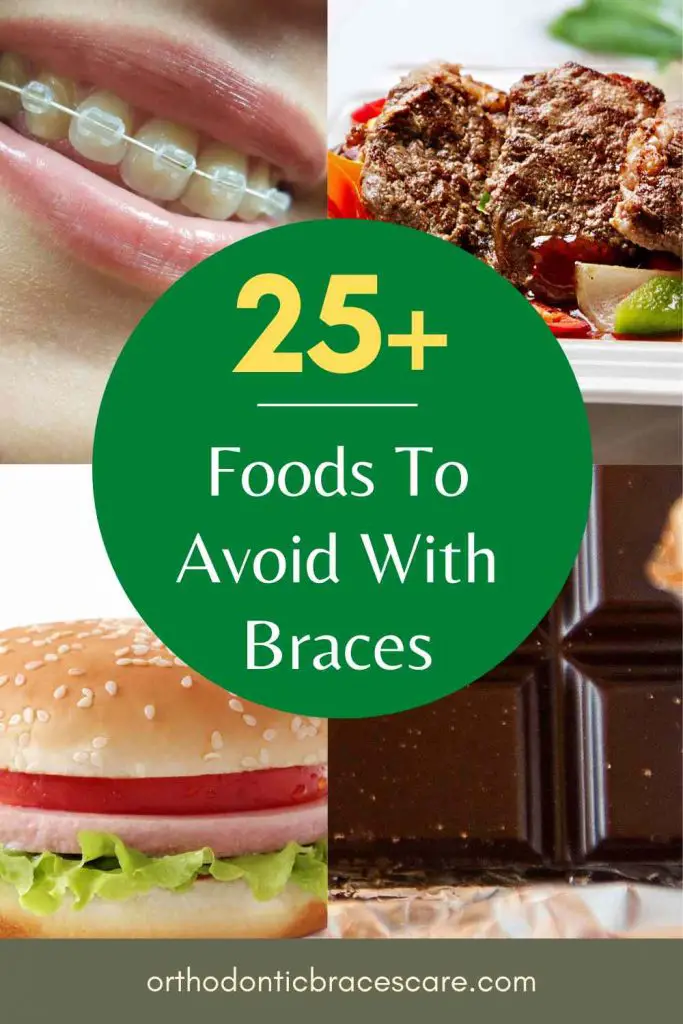 Foods to avoid with braces on teeth