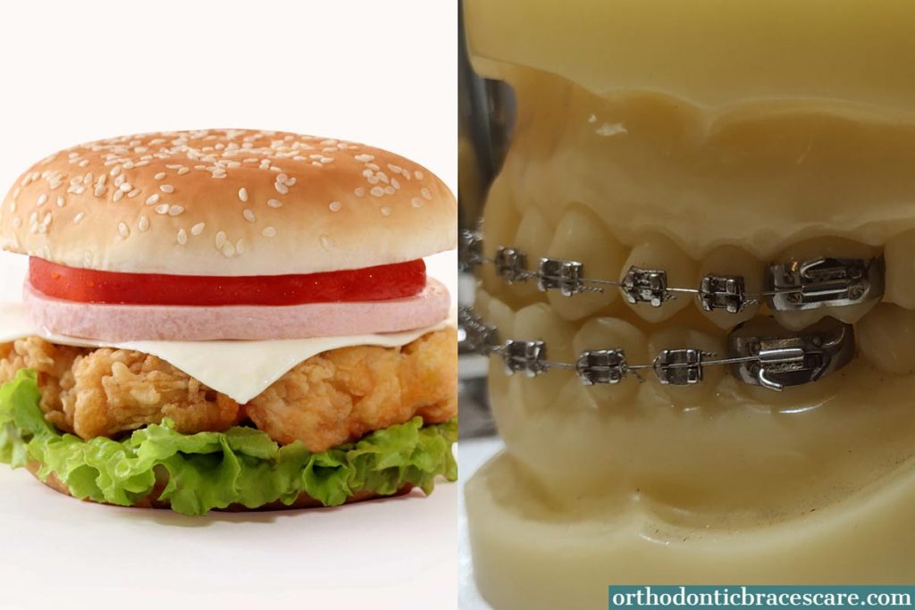 eating burger with braces