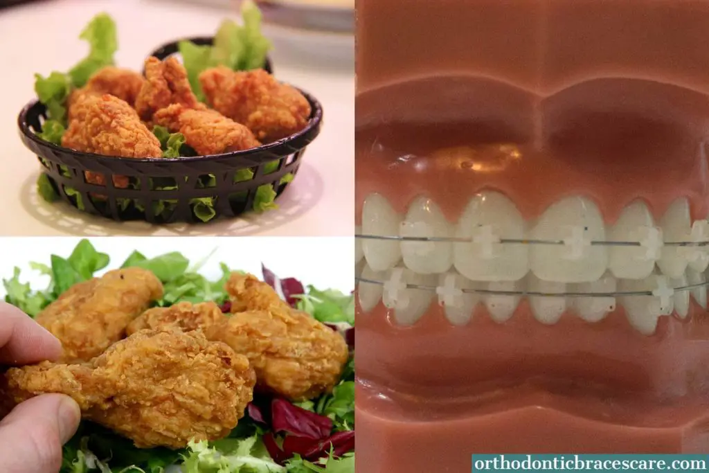 Can I Eat Chicken With Braces