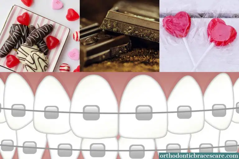 Can You Eat Candy or Chocolate With Braces? [5 Ideas] Orthodontic Braces Care