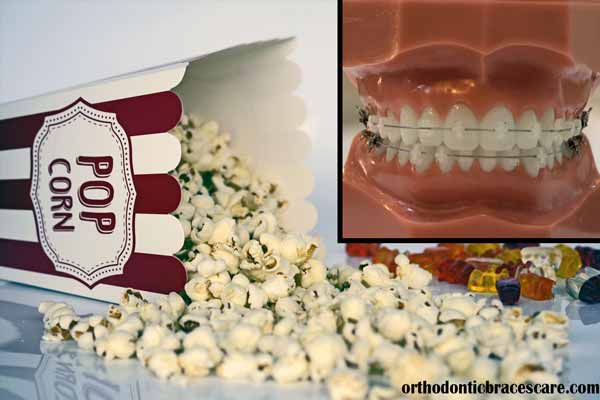 eating popcorn with braces