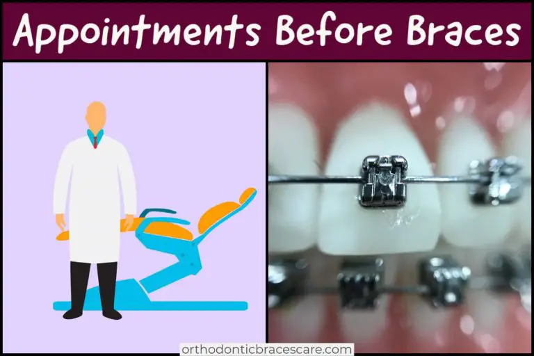 How Many Appointments Before Getting Braces - Orthodontic Braces Care