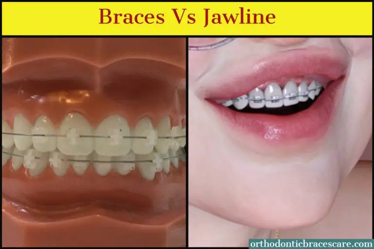 Can Braces Change Your Jawline? How? Orthodontic Braces Care