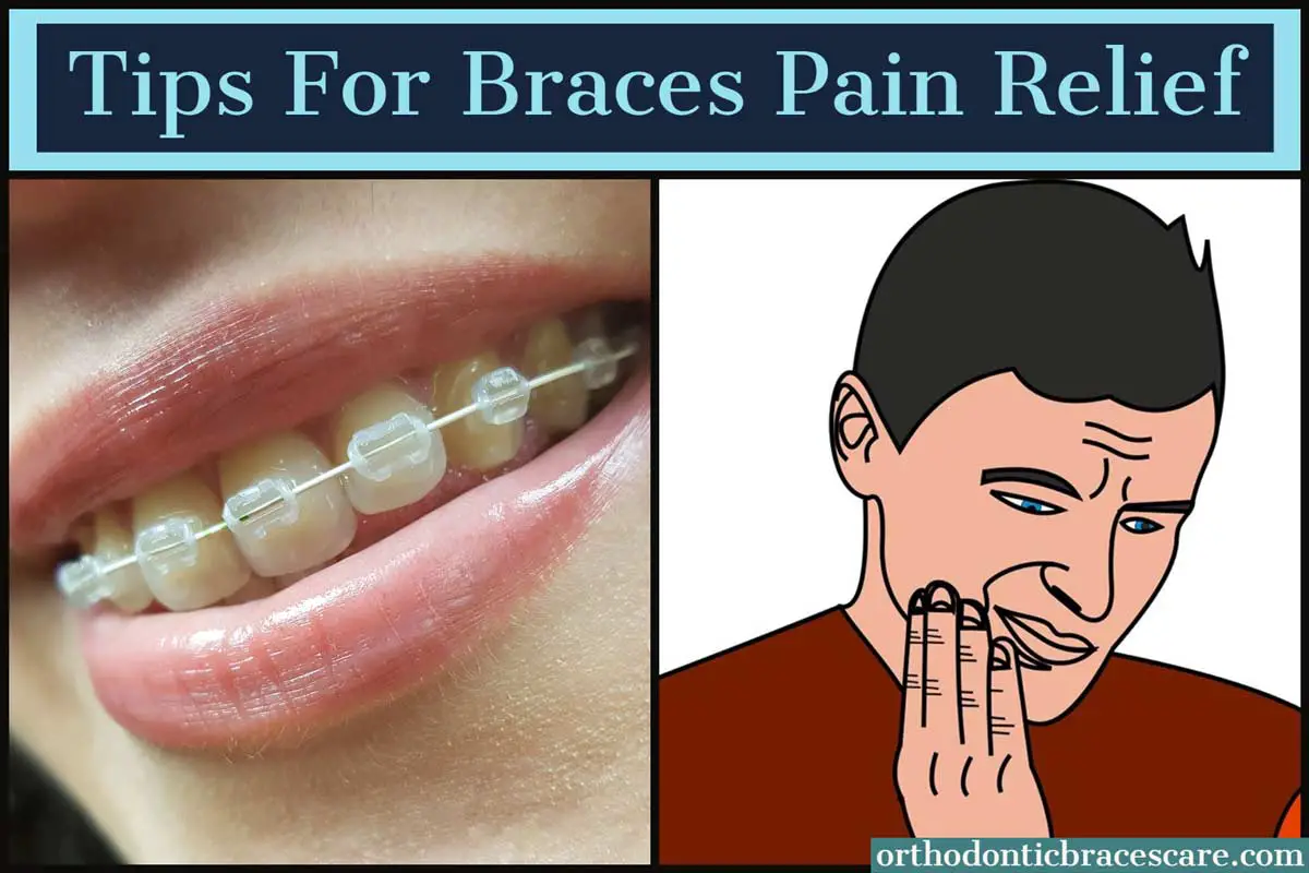 Tips for Braces Pain Relief