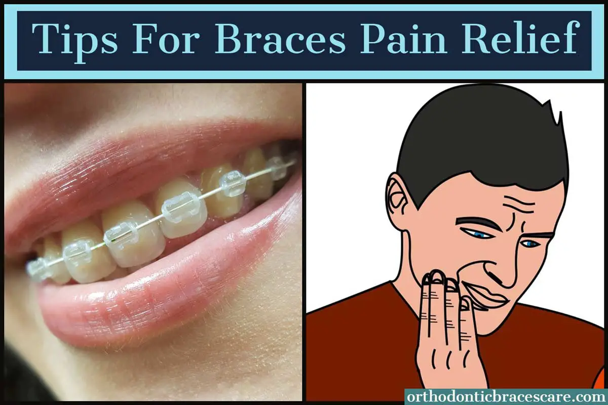 How To Relieve Pain From Braces [25+ Tips] Orthodontic Braces Care