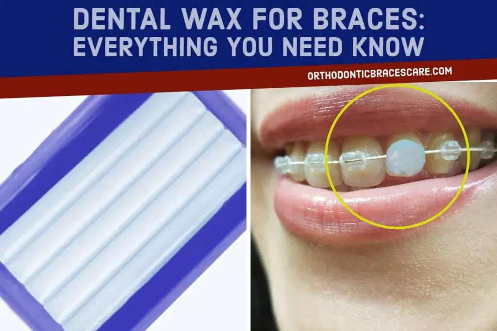Dental wax for braces