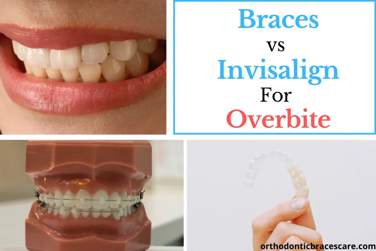 invisible braces vs invisalign