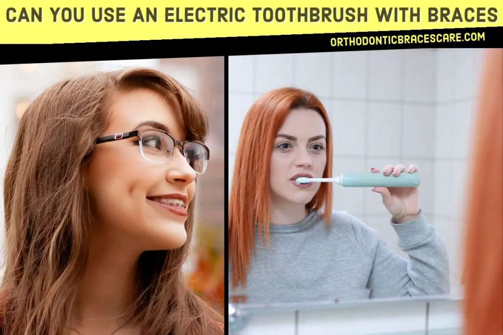 An Electric Toothbrush and Braces