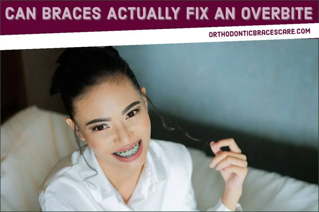 Can Braces Actually Fix An Overbite