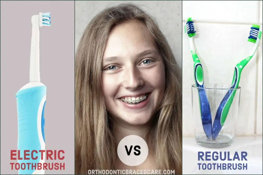 A Manual or Electric Toothbrush Better For Braces