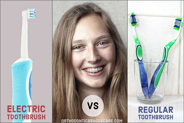 Is A Manual or Electric Toothbrush Better For Braces