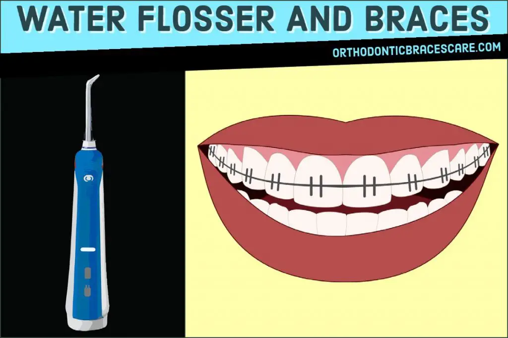 Waterpik Flosser Safe And Effective For Braces