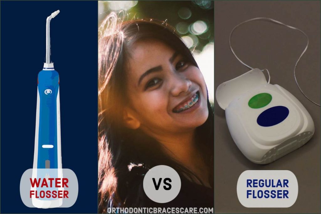 Waterpik vs flossing for braces