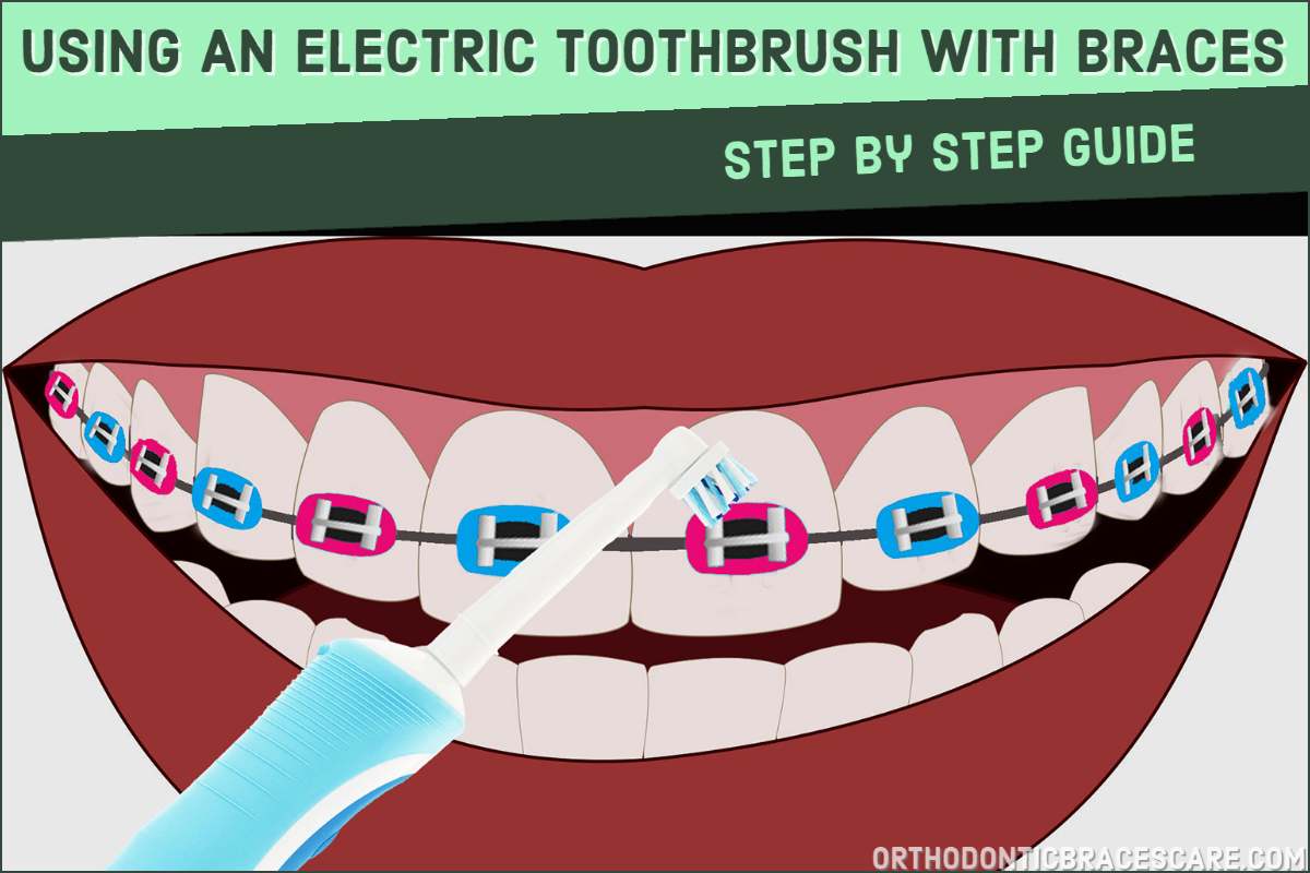 How To Use An Electric Toothbrush With Braces Orthodontic Braces Care