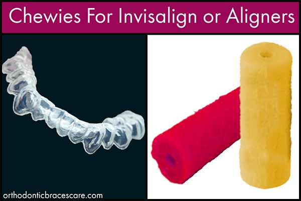 Top Chewies for Invisalign