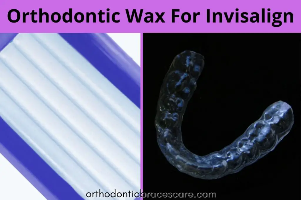 Orthodontic wax for Invisalign