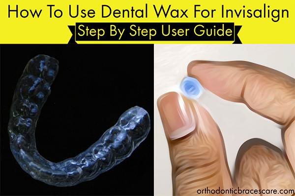 How To Use Dental Wax On Invisalign