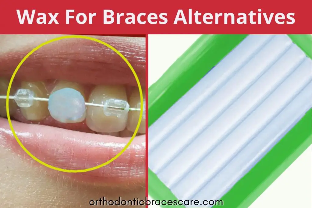 Wax for braces alternatives