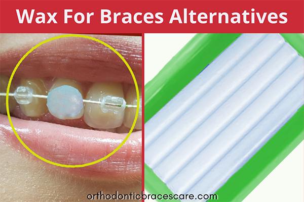 Alternatives to Wax for Braces