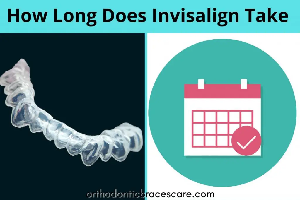 How long Invisalign takes