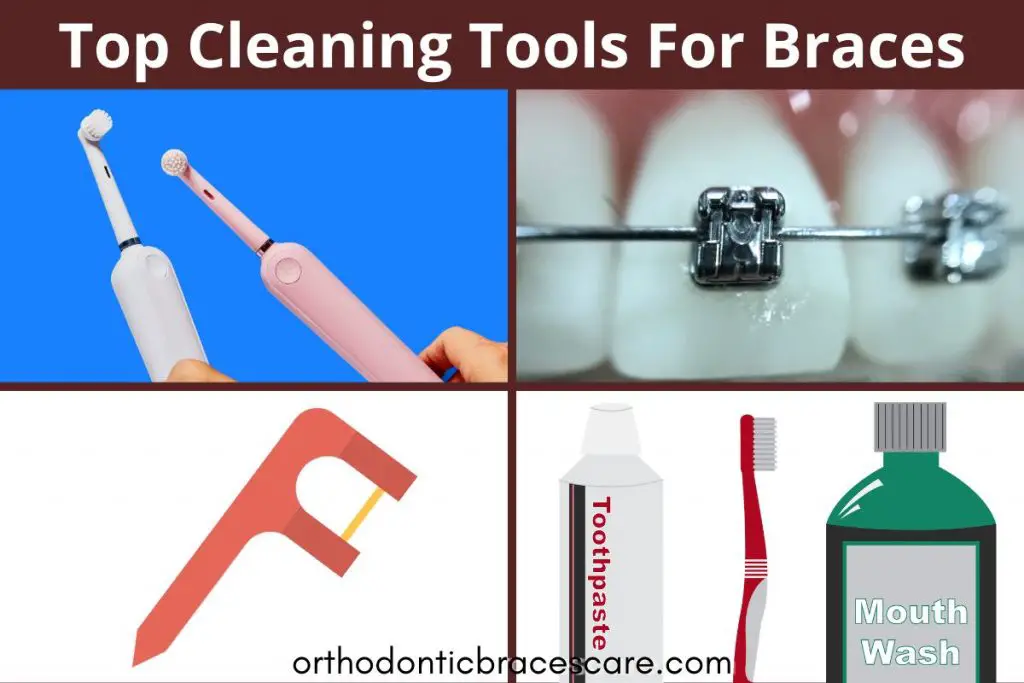 Best Cleaning tools for braces