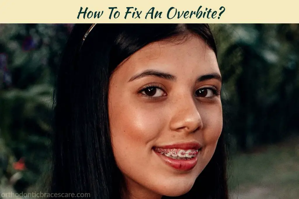 Ways to fix an overbite