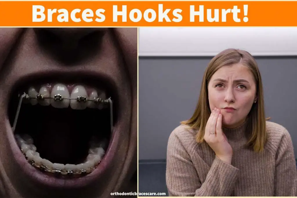 Braces hooks hurt: why this happens, How to fix