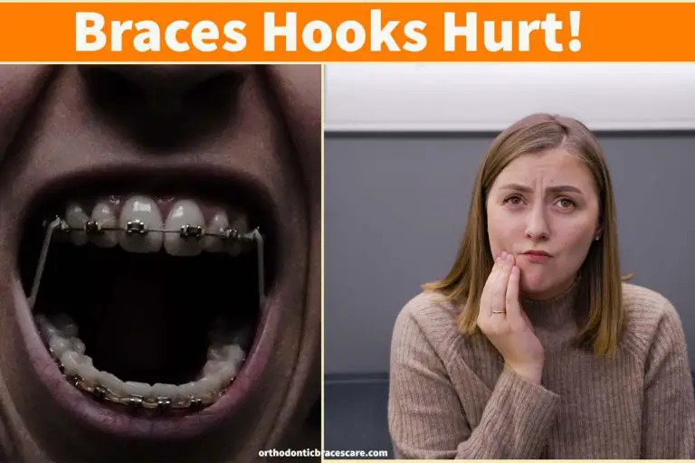 Braces Hooks Hurt And Tear Cheek Causes, What To Do Orthodontic