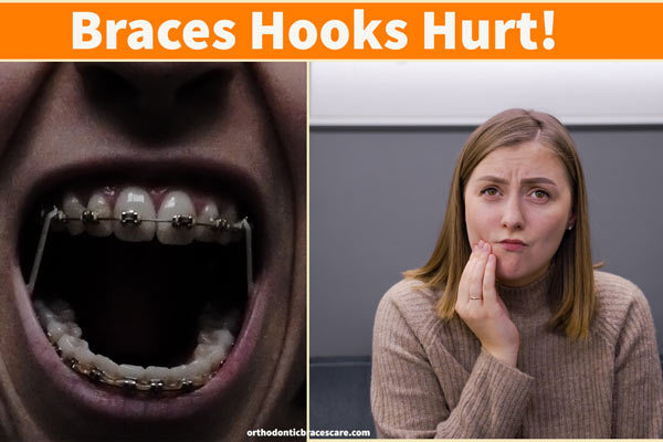 Braces hooks hurt or tear cheek: Causes, What to do