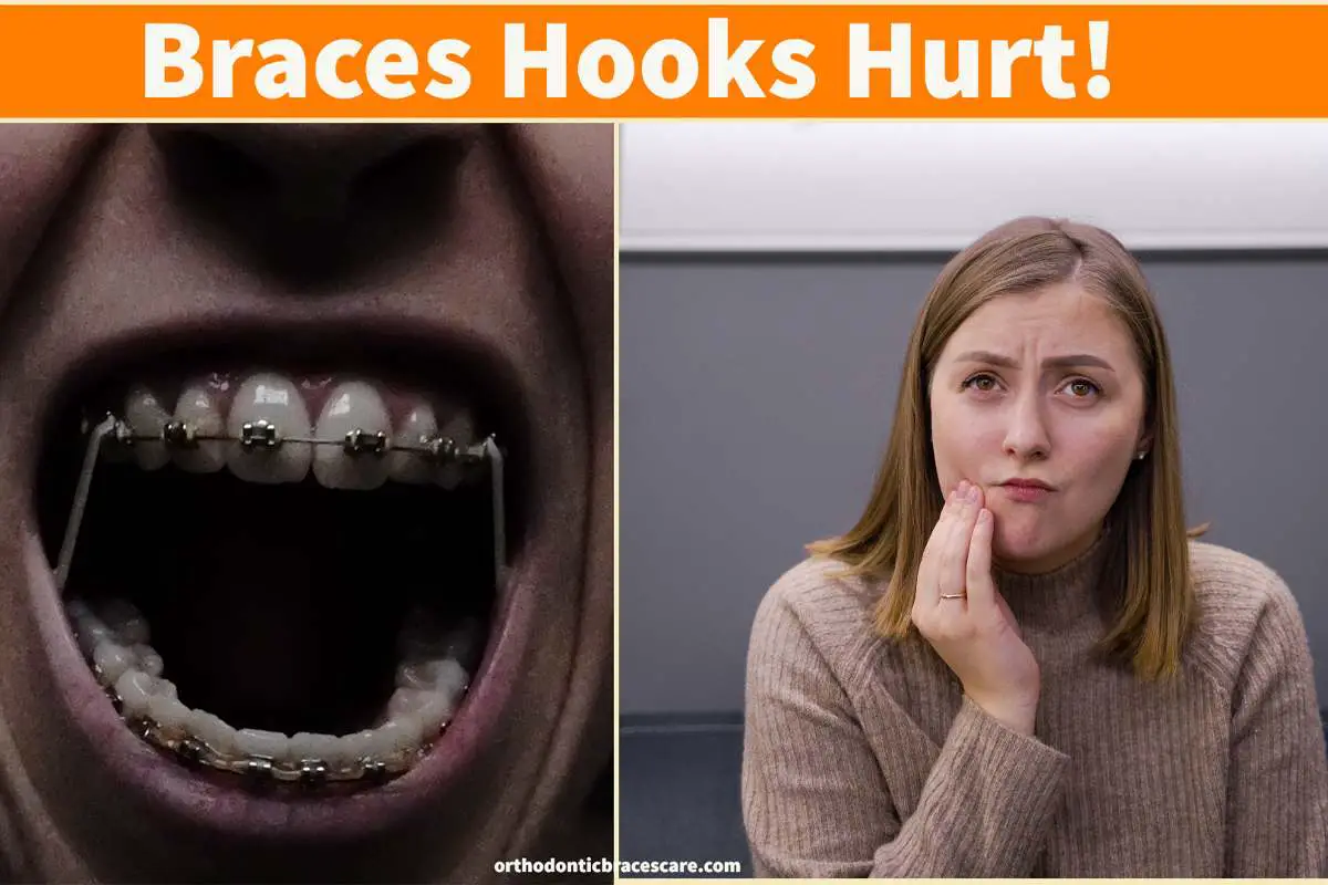 Braces Hooks Hurt And Tear Cheek Causes, What To Do Orthodontic