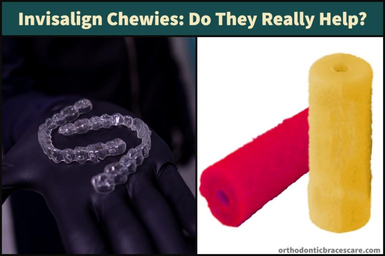 Invisalign Chewies Do They Really Help, Do you need them