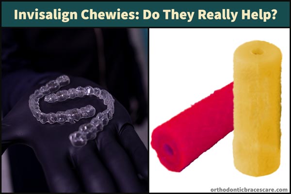 Invisalign chewies or aligner seaters